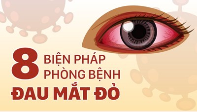 8 biện pháp phòng bệnh đau mắt đỏ