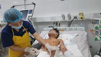 TPHCM: Nhiều trẻ em nhập viện do tự chế pháo dịp cận Tết