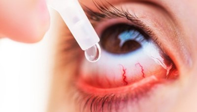 Cảnh báo tình trạng dùng kháng sinh chữa đau mắt đỏ