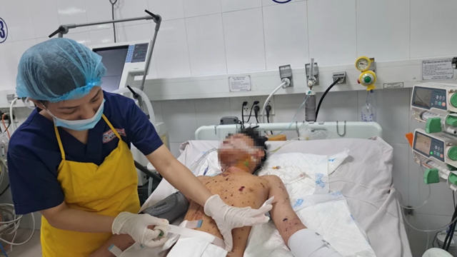 TPHCM: Nhiều trẻ em nhập viện do tự chế pháo dịp cận Tết