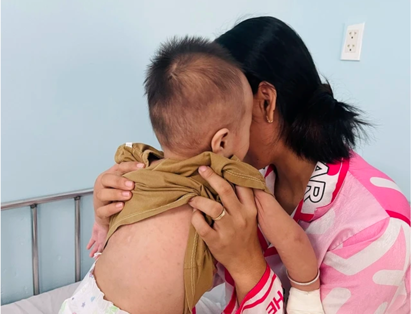 Trẻ mắc bệnh sởi đang điều trị tại Bệnh viện Nhi đồng 1